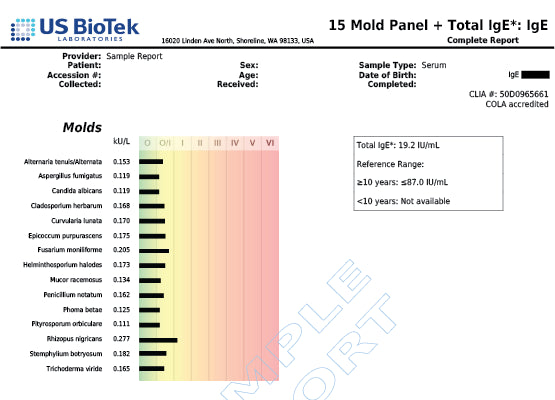15 Mold Allergy Panel Image
