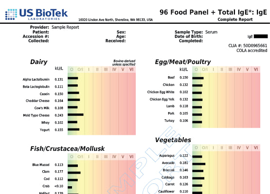 96 Food Allergy Panel Image